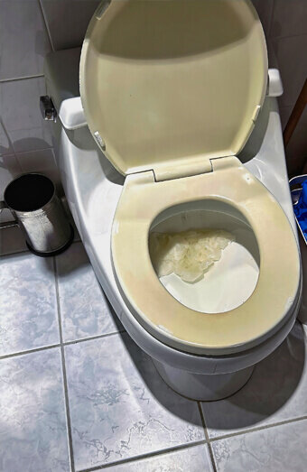 https://blockeddrainshocking.com.au/uploads/2025/07/blocked-toilet-27293.jpg